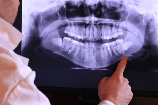 Best Emergency Dental Care for Broken or Chipped Teeth in Plattsburg, MO