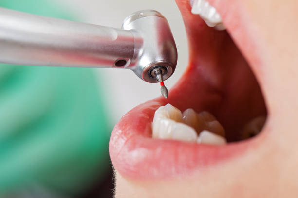 Best Emergency Gum Treatment in Plattsburg, MO
